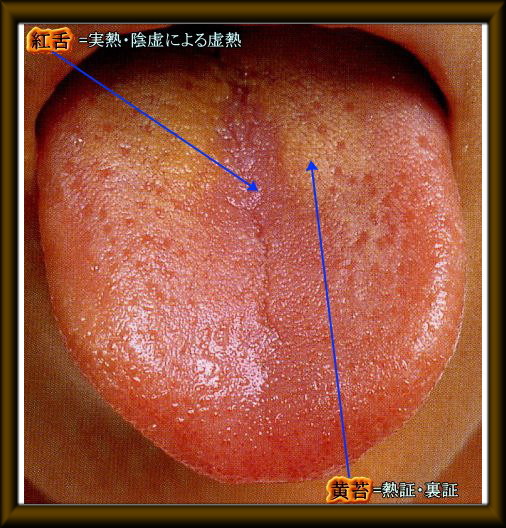 舌診