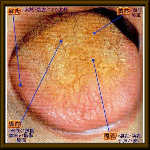 舌診