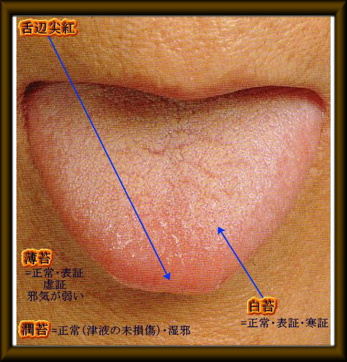 舌診