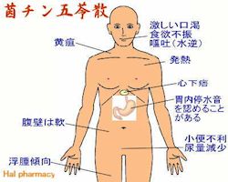 茵蔯五苓散