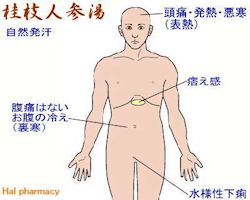 桂枝人参湯